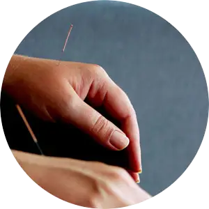acupuncture-circle